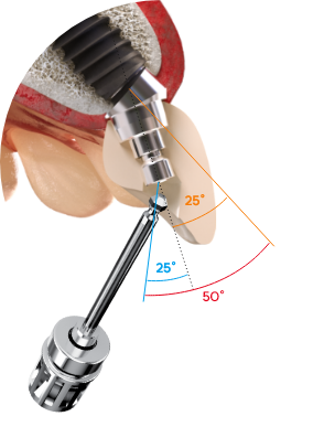 Angled Crown image